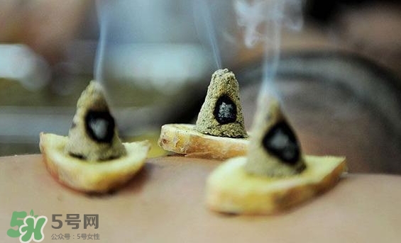 貼三伏貼可以艾灸嗎？貼三伏貼多久可以艾灸