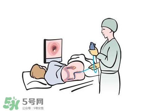 直腸癌怎么查出來的？直腸癌怎么判斷早晚期