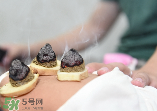 三伏灸什么人不能做？三伏灸適合哪些人？