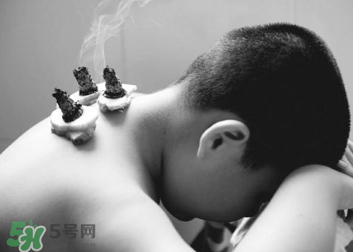 三伏灸什么人不能做？三伏灸適合哪些人？