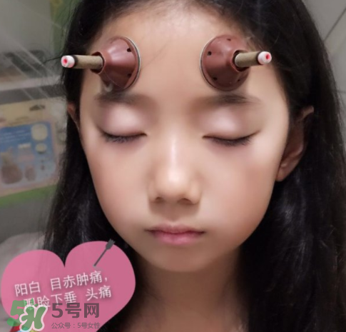 艾灸貼可以治咳嗽嗎？艾灸貼可以治退燒嗎？