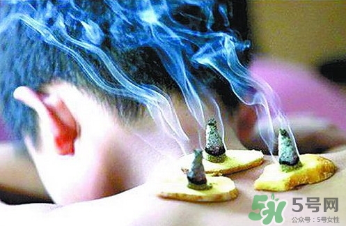 三伏灸什么時(shí)候開(kāi)始灸？三伏灸怎么灸？
