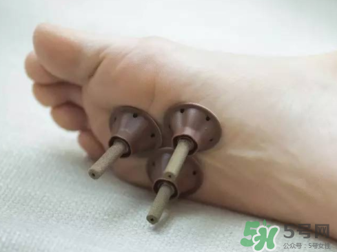 艾艾貼灸出水珠為什么？艾艾貼后有水珠要擦嗎？