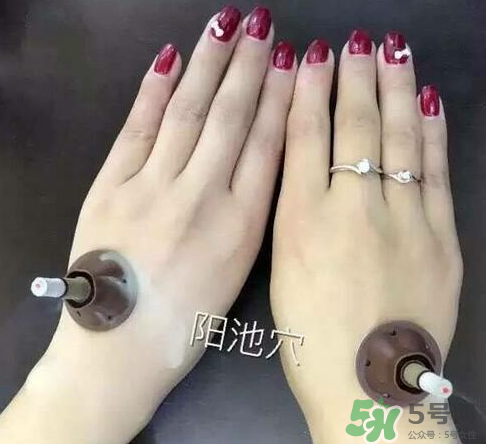 艾艾貼灸出水珠為什么？艾艾貼后有水珠要擦嗎？
