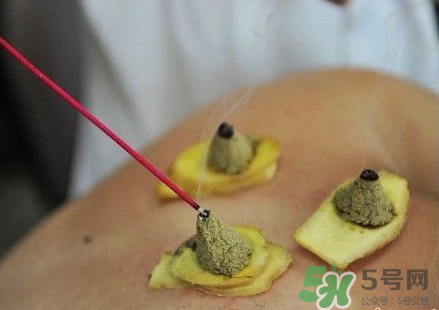三伏灸可以自己灸嗎？三伏灸可以在家做嗎？