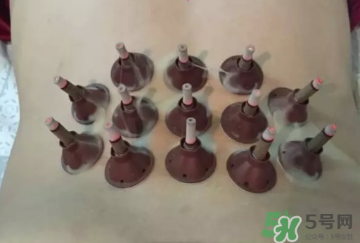 艾艾貼可以貼肚臍眼嗎？艾艾貼貼肚臍有什么作用？
