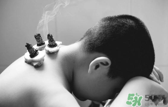 三伏灸要灸幾次？三伏灸要灸多久？