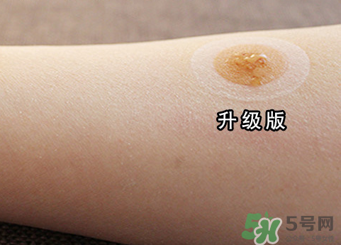 艾灸貼后有水泡怎么辦？貼艾灸貼應(yīng)注意些什么？