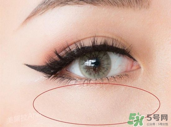 玻尿酸填充淚溝多久恢復(fù)自然？玻尿酸填充淚溝的危害