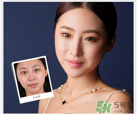 填充淚溝有風(fēng)險嗎？填充淚溝的方法