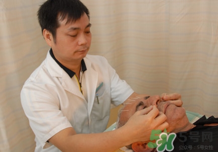 針灸可以治療失眠嗎？失眠時針灸哪些穴位有效