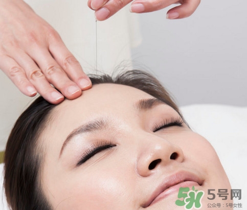 針灸可以自己扎嗎？針灸可以減肥嗎