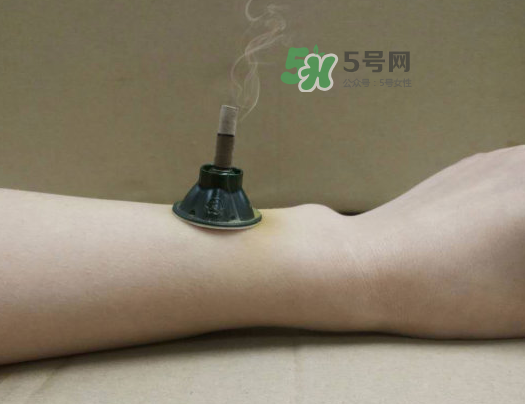 三伏天下雨可以艾灸嗎？三伏天下雨艾灸好嗎？