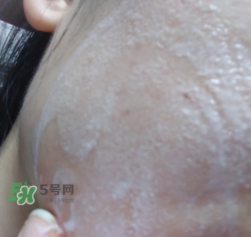 貝蜜清凈痘控油潔面啫喱怎么樣？貝蜜清祛痘控油潔面啫喱好用嗎？