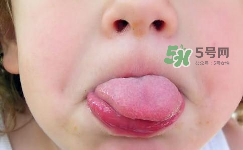 三伏天為什么濕氣重？三伏天為什么要注意祛濕？