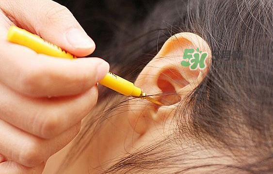 兒童耳屎成硬塊怎么辦？?jī)和撼捎矇K有危害嗎？