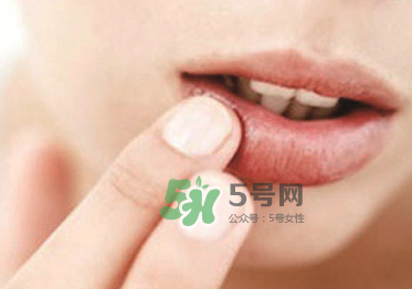 你的嘴唇為什么起泡 嘴唇上的水泡治不好嗎？