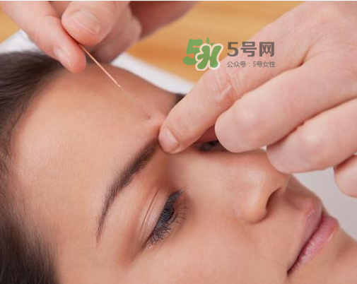 三伏天針灸有什么好處？三伏天針灸注意什么？