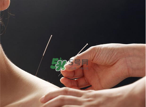 三伏天針灸有什么好處？三伏天針灸注意什么？