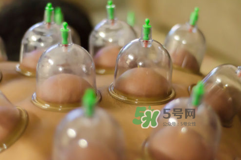 拔火罐是夏天好還是冬天好？什么時候拔火罐最合適？