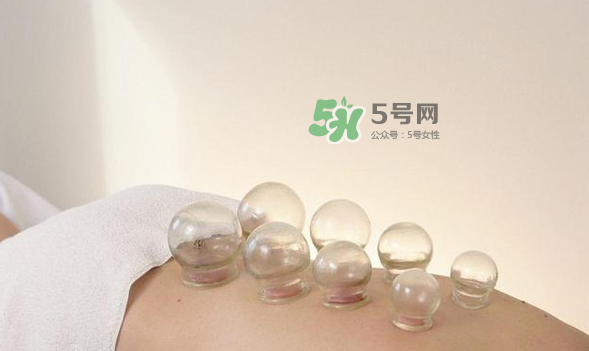 拔火罐是夏天好還是冬天好？什么時候拔火罐最合適？