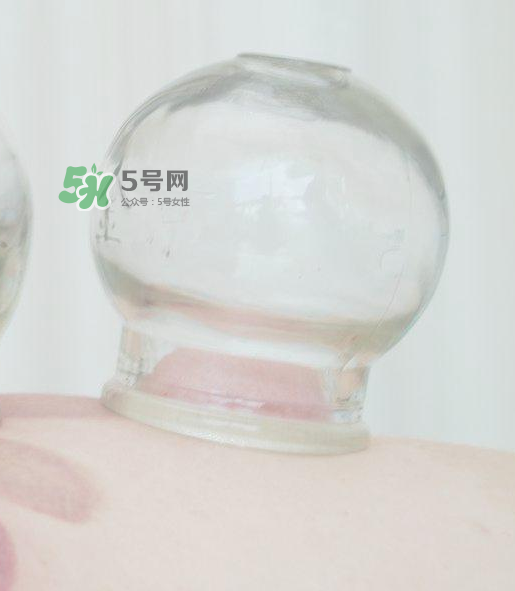 拔火罐一次多長時(shí)間？拔火罐一般多長時(shí)間？
