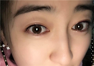 做美瞳線會不會掉睫毛？做美瞳線掉睫毛怎么辦？