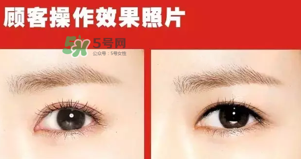 美瞳線有必要做嗎？做美瞳線多少錢？