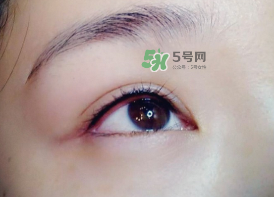 做美瞳線疼嗎？做美瞳線后要注意什么？
