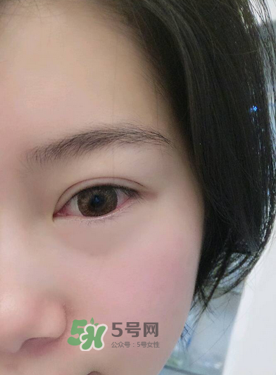 做美瞳線疼嗎？做美瞳線后要注意什么？