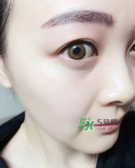 做美瞳線對眼睛有傷害嗎？做美瞳線會傷眼睛嗎？