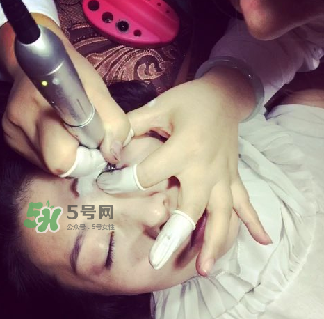 做美瞳線要打麻藥嗎？做美瞳線麻藥怎么敷？