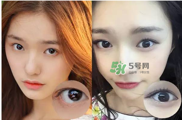 做美瞳線會(huì)不會(huì)掉睫毛？做美瞳線掉睫毛怎么辦？