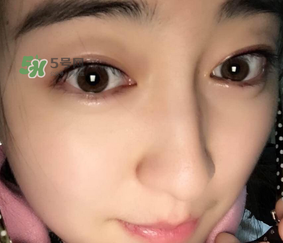做美瞳線可以喝酒嗎？做美瞳線喝酒有影響嗎？