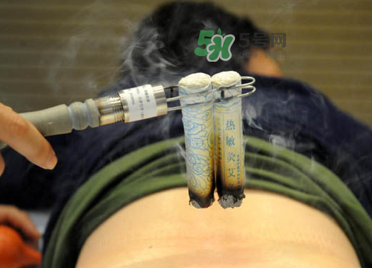三伏天艾灸后能吹空調(diào)嗎？三伏天艾灸后能吹電扇嗎？