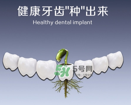種植牙費用多少錢？國產(chǎn)種植牙價格