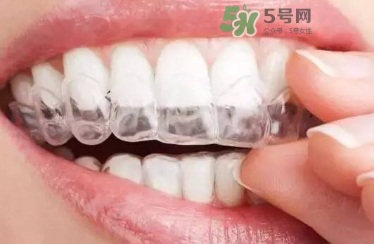 牙齒有縫隙可以補(bǔ)嗎？牙齒縫隙大能補(bǔ)嗎