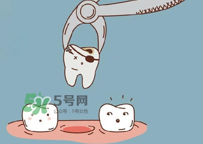 智齒是每個人都會長嗎？拔智齒能瘦臉嗎？