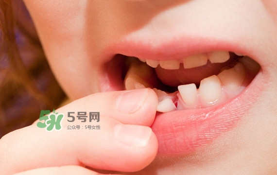 牙齒松動(dòng)可以重新長(zhǎng)牢固嗎？牙齒松動(dòng)可以修復(fù)嗎