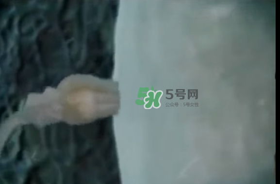 懷孕初期怎么保胎？陰道出血是流產(chǎn)征兆嗎？