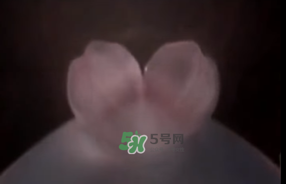 懷孕初期怎么保胎？陰道出血是流產(chǎn)征兆嗎？