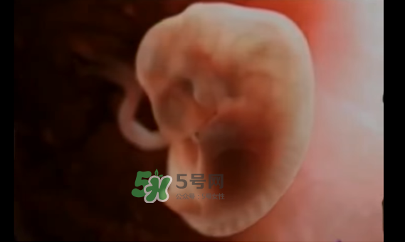 懷孕初期怎么保胎？陰道出血是流產(chǎn)征兆嗎？