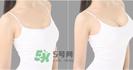 女性乳頭癢是怎么回事？女性乳頭癢要怎么治療？