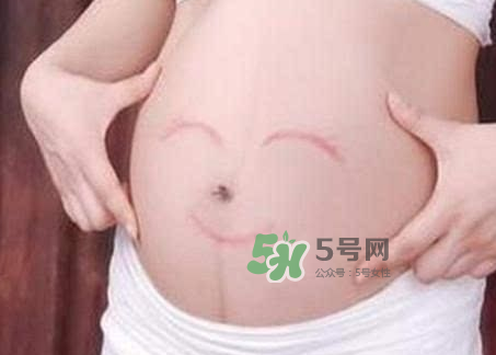 產(chǎn)婦胃脹氣怎么緩解？產(chǎn)婦胃脹氣怎么辦？