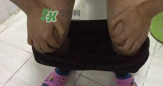 孕期可以蹲著上廁所嗎？孕期上廁所會壓到寶寶嗎？