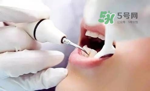 孕婦能矯正牙齒嗎？懷孕期間可以矯正牙齒嗎？