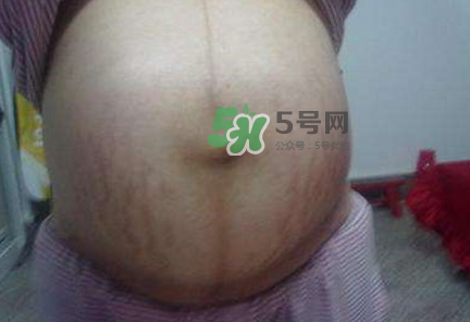 懷女孩肚子上會長毛嗎？懷女孩肚子特征圖片