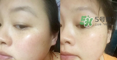 可思美潔面儀好不好用？可思美凈致潔顏聲波潔面儀怎么樣？
