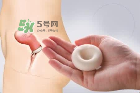 殺精劑有什么副作用？殺精劑的使用方法