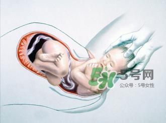 順產(chǎn)和剖腹產(chǎn)哪個(gè)好？順產(chǎn)和剖腹產(chǎn)哪個(gè)痛？